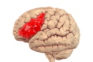 an image of the brain with broca's area highlighted